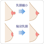 乳頭縮小・陥没乳頭