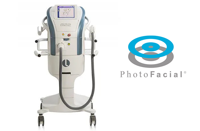 フォトフェイシャルとは？？