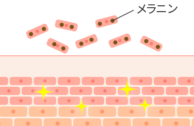 数日後で皮膚の代謝により自然に剥がれ落ちます
